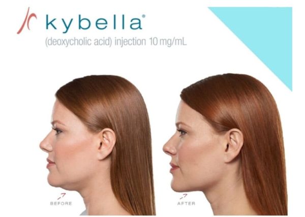 Kybella™ Non Surgical Treatment For A Double Chin Enhanced Aesthetics And Wellness 